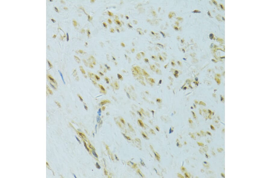 Immunohistochemistry - Anti-XBP1 Antibody (A14651) - Antibodies.com
