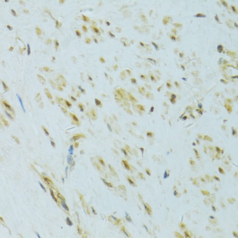 Immunohistochemistry - Anti-XBP1 Antibody (A14651) - Antibodies.com