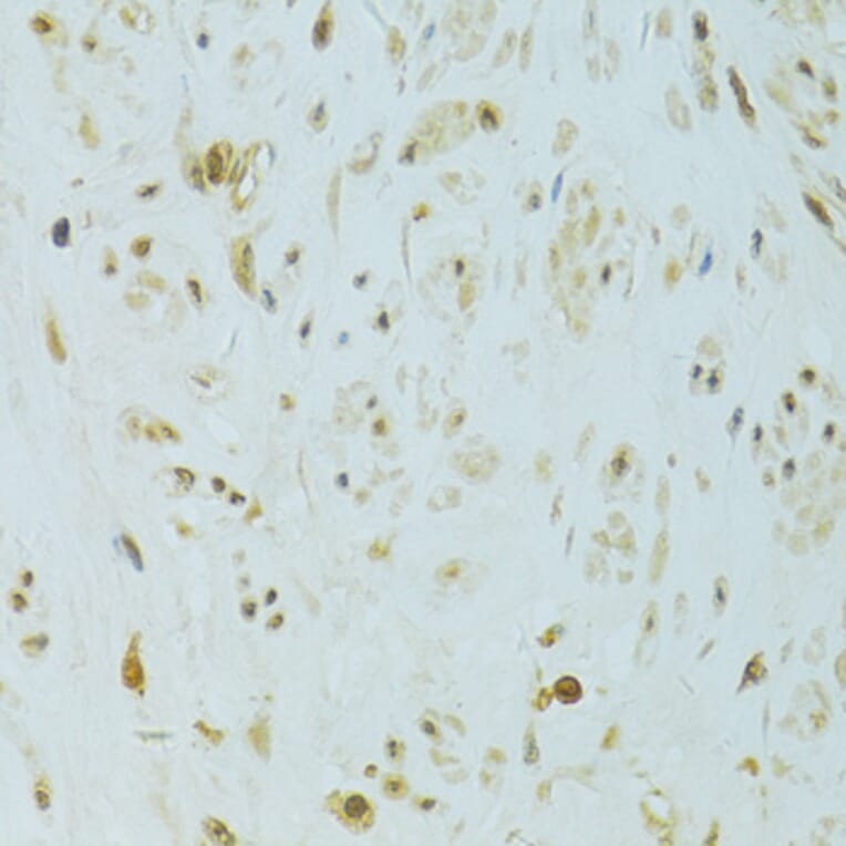 Immunohistochemistry - Anti-XBP1 Antibody (A14651) - Antibodies.com