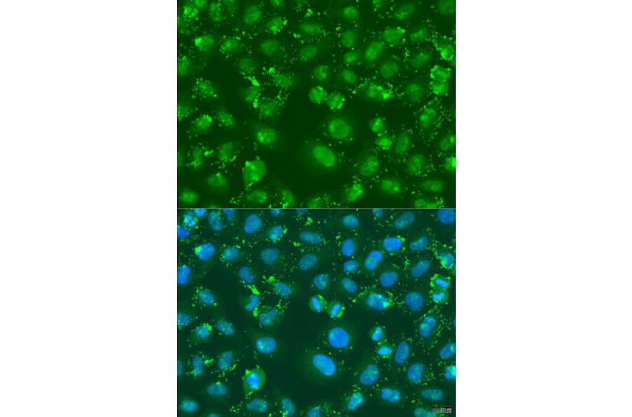 Immunofluorescence - Anti-XBP1 Antibody (A14651) - Antibodies.com