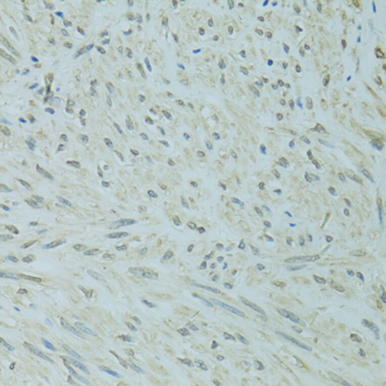 Immunohistochemistry - Anti-XBP1 Antibody (A14860) - Antibodies.com