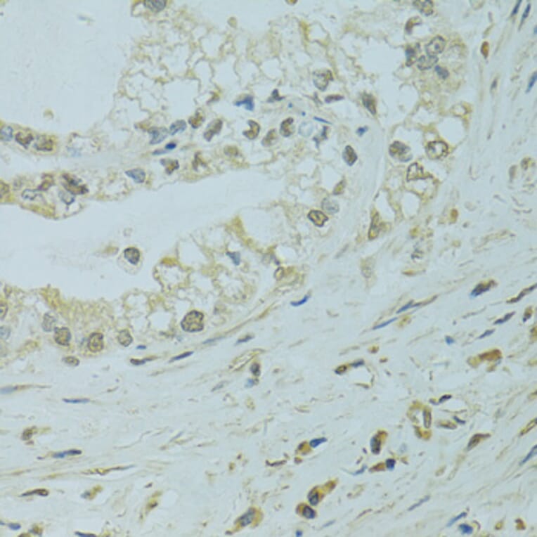 Immunohistochemistry - Anti-XBP1 Antibody (A14860) - Antibodies.com