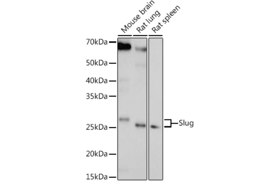 Western Blot - Anti-SLUG Antibody (A92066) - Antibodies.com