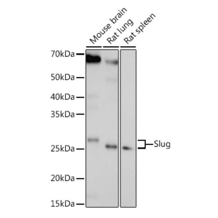 Western Blot - Anti-SLUG Antibody (A92066) - Antibodies.com