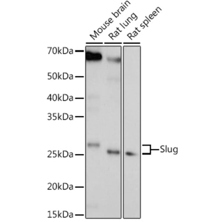 Western Blot - Anti-SLUG Antibody (A92066) - Antibodies.com