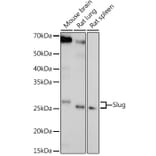 Western Blot - Anti-SLUG Antibody (A92066) - Antibodies.com