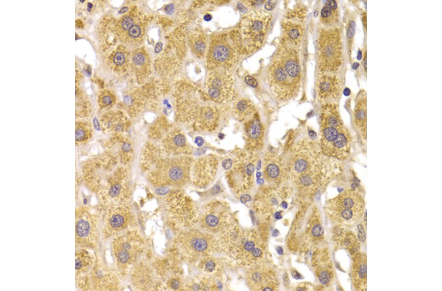 Immunohistochemistry - Anti-SLUG Antibody (A92066) - Antibodies.com