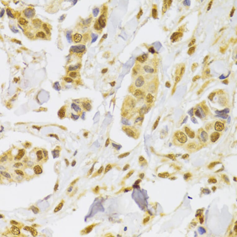 Immunohistochemistry - Anti-SLUG Antibody (A92066) - Antibodies.com