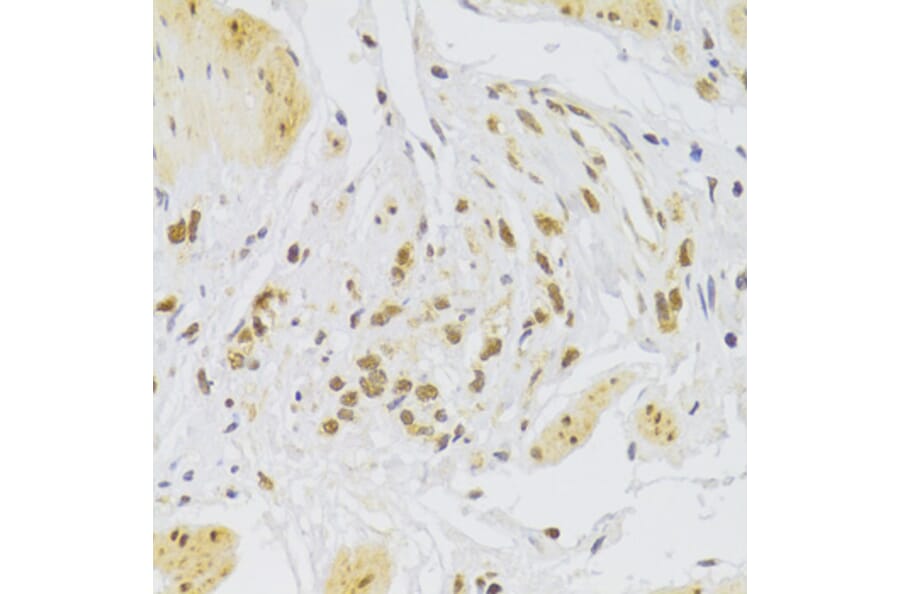 Immunohistochemistry - Anti-SLUG Antibody (A92066) - Antibodies.com