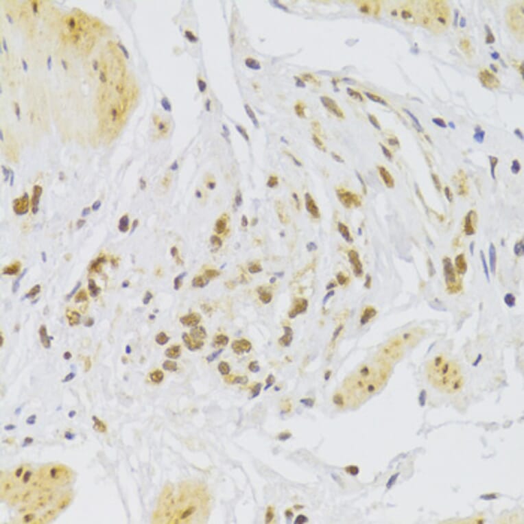 Immunohistochemistry - Anti-SLUG Antibody (A92066) - Antibodies.com