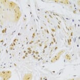 Immunohistochemistry - Anti-SLUG Antibody (A92066) - Antibodies.com