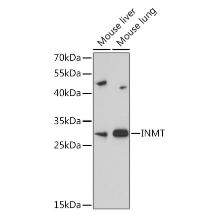 Western Blot - Anti-TEMT Antibody (A92067) - Antibodies.com