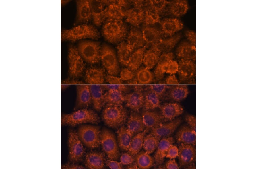 Immunofluorescence - Anti-TEMT Antibody (A92067) - Antibodies.com