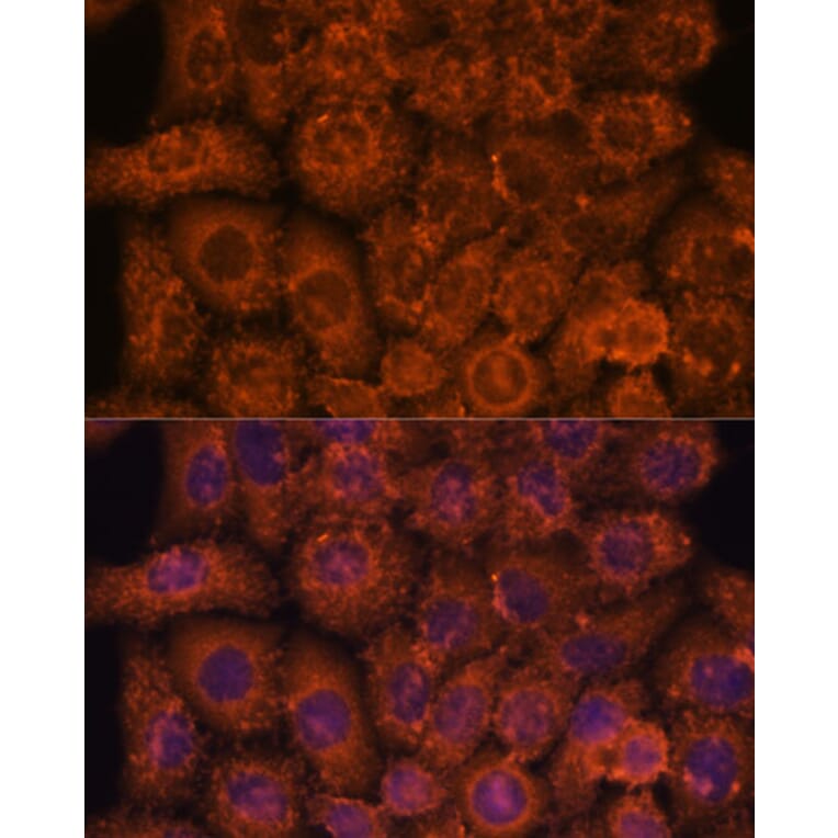 Immunofluorescence - Anti-TEMT Antibody (A92067) - Antibodies.com