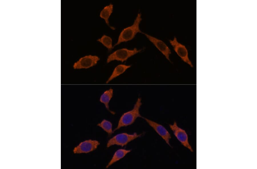 Immunofluorescence - Anti-TEMT Antibody (A92067) - Antibodies.com