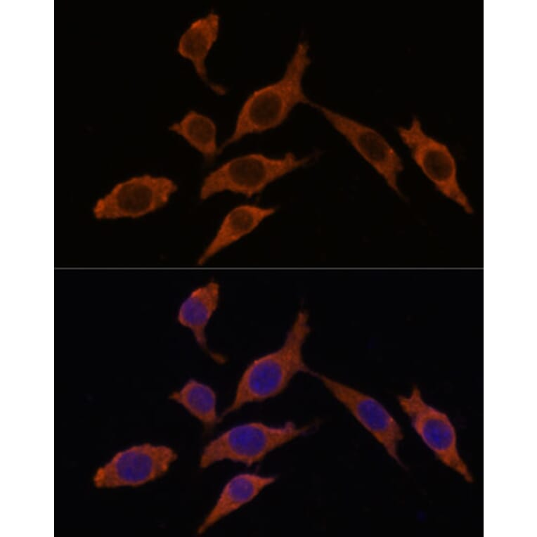 Immunofluorescence - Anti-TEMT Antibody (A92067) - Antibodies.com