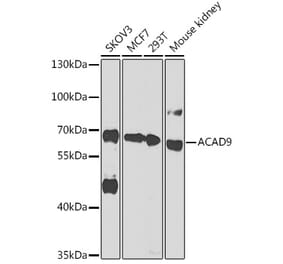Western Blot - Anti-ACAD9 Antibody (A92069) - Antibodies.com