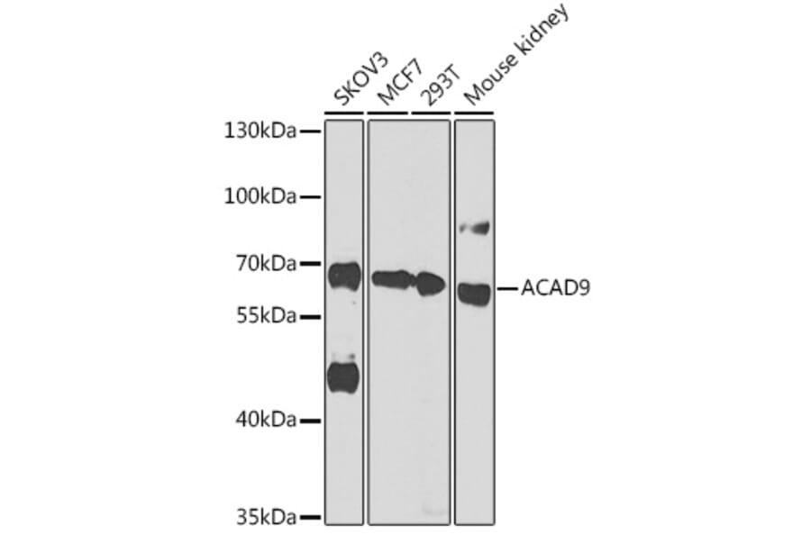 Western Blot - Anti-ACAD9 Antibody (A92069) - Antibodies.com