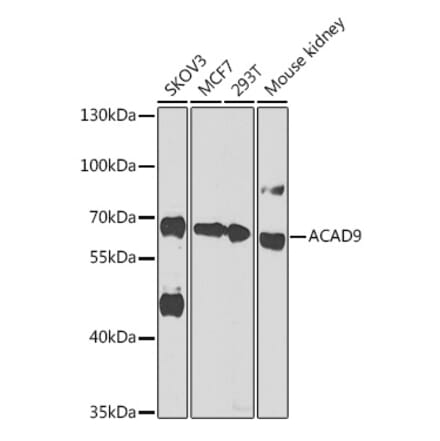 Western Blot - Anti-ACAD9 Antibody (A92069) - Antibodies.com