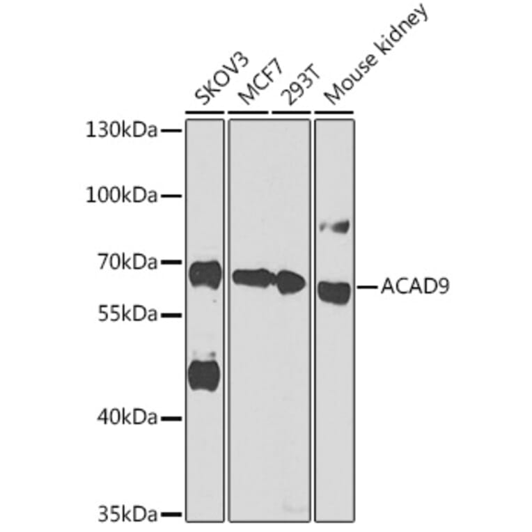 Western Blot - Anti-ACAD9 Antibody (A92069) - Antibodies.com