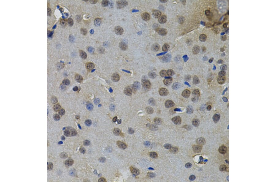 Immunohistochemistry - Anti-IL33 Antibody (A12604) - Antibodies.com