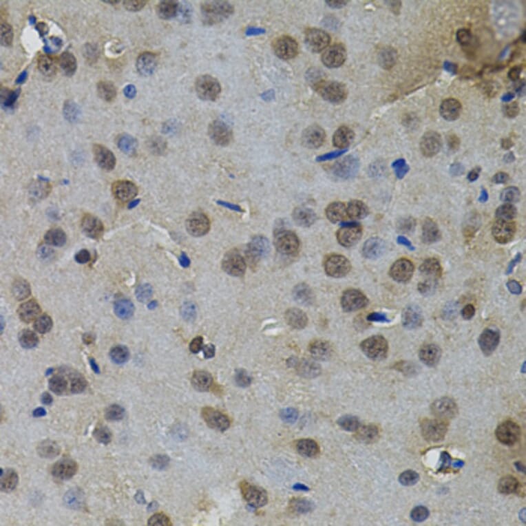 Immunohistochemistry - Anti-IL33 Antibody (A12604) - Antibodies.com