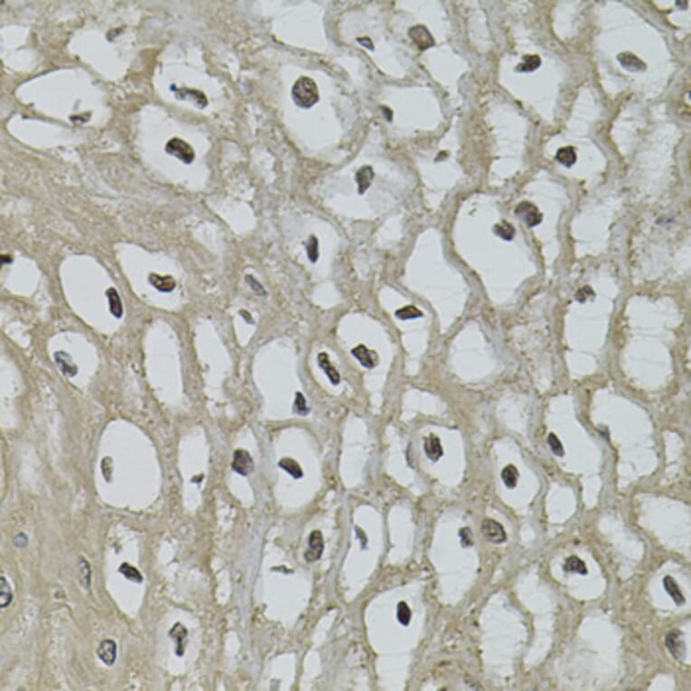 Immunohistochemistry - Anti-IL33 Antibody (A12604) - Antibodies.com
