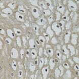 Immunohistochemistry - Anti-IL33 Antibody (A12604) - Antibodies.com