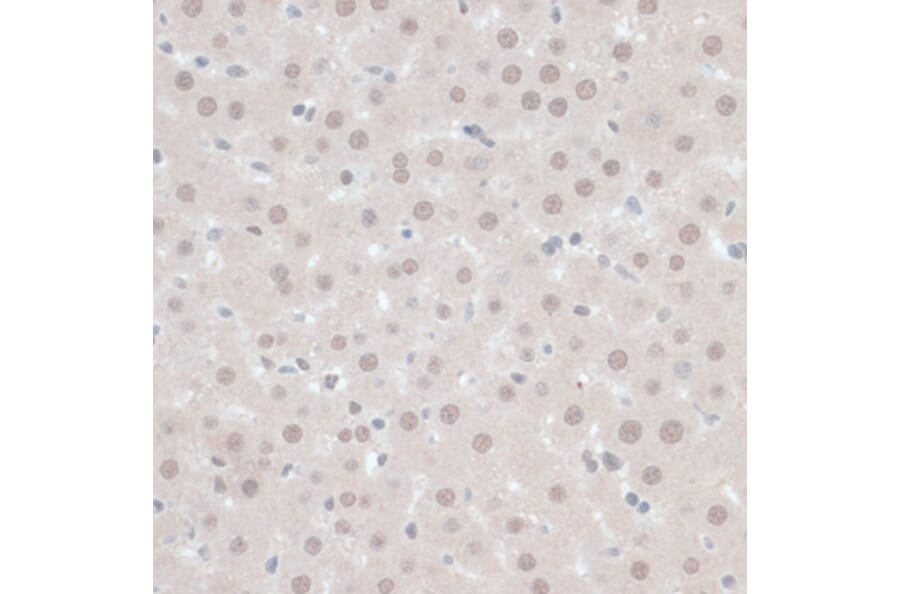 Immunohistochemistry - Anti-ZNF446 Antibody (A14912) - Antibodies.com