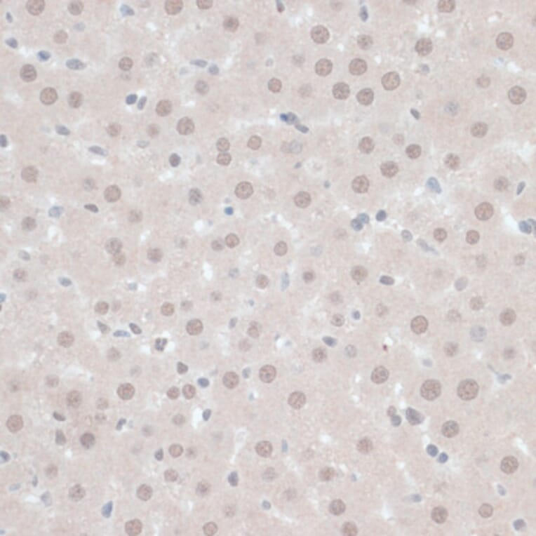 Immunohistochemistry - Anti-ZNF446 Antibody (A14912) - Antibodies.com