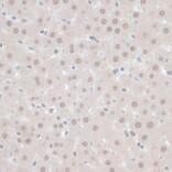 Immunohistochemistry - Anti-ZNF446 Antibody (A14912) - Antibodies.com