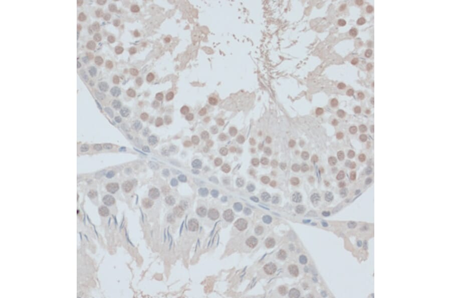 Immunohistochemistry - Anti-ZNF446 Antibody (A14912) - Antibodies.com