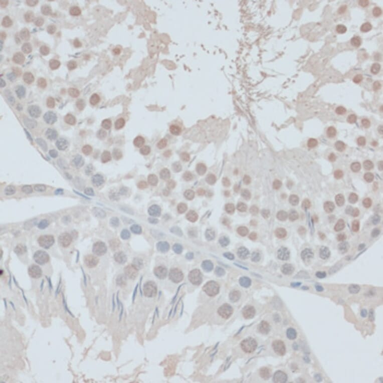 Immunohistochemistry - Anti-ZNF446 Antibody (A14912) - Antibodies.com
