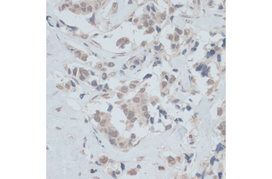 Immunohistochemistry - Anti-ZNF446 Antibody (A14912) - Antibodies.com