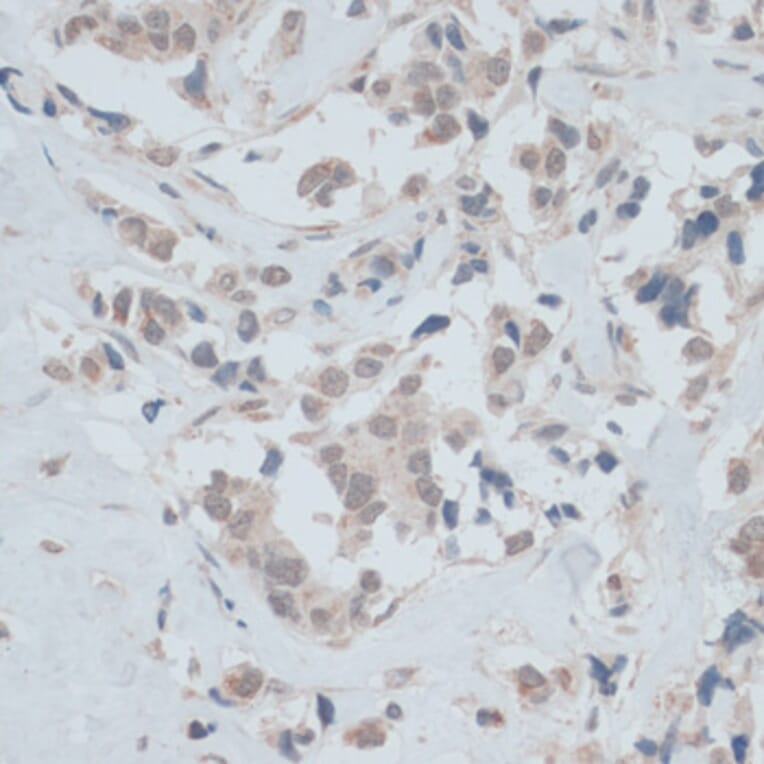 Immunohistochemistry - Anti-ZNF446 Antibody (A14912) - Antibodies.com