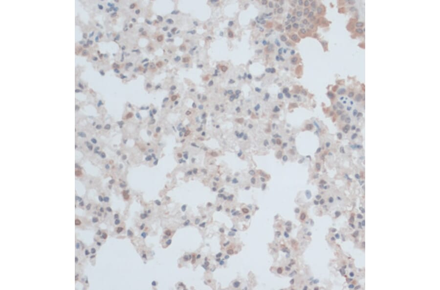 Immunohistochemistry - Anti-ZNF446 Antibody (A14912) - Antibodies.com