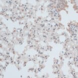Immunohistochemistry - Anti-ZNF446 Antibody (A14912) - Antibodies.com