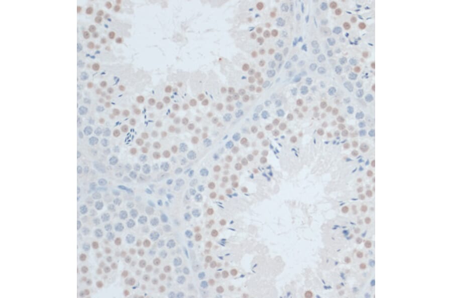 Immunohistochemistry - Anti-ZNF446 Antibody (A14912) - Antibodies.com