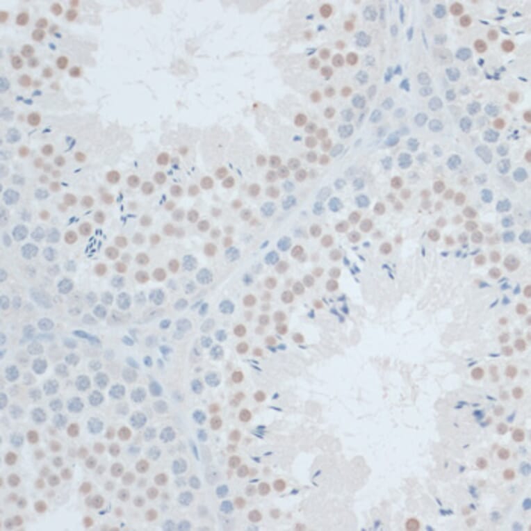 Immunohistochemistry - Anti-ZNF446 Antibody (A14912) - Antibodies.com