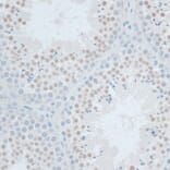 Immunohistochemistry - Anti-ZNF446 Antibody (A14912) - Antibodies.com