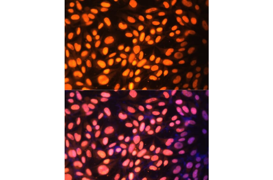 Immunofluorescence - Anti-ZNF446 Antibody (A14912) - Antibodies.com