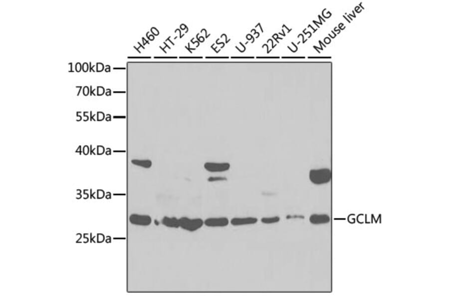 Western Blot - Anti-GCLM Antibody (A92075) - Antibodies.com
