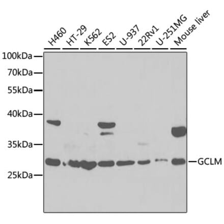 Western Blot - Anti-GCLM Antibody (A92075) - Antibodies.com