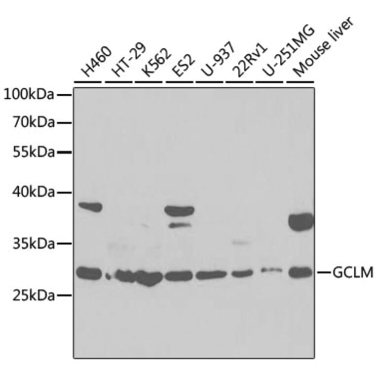 Western Blot - Anti-GCLM Antibody (A92075) - Antibodies.com