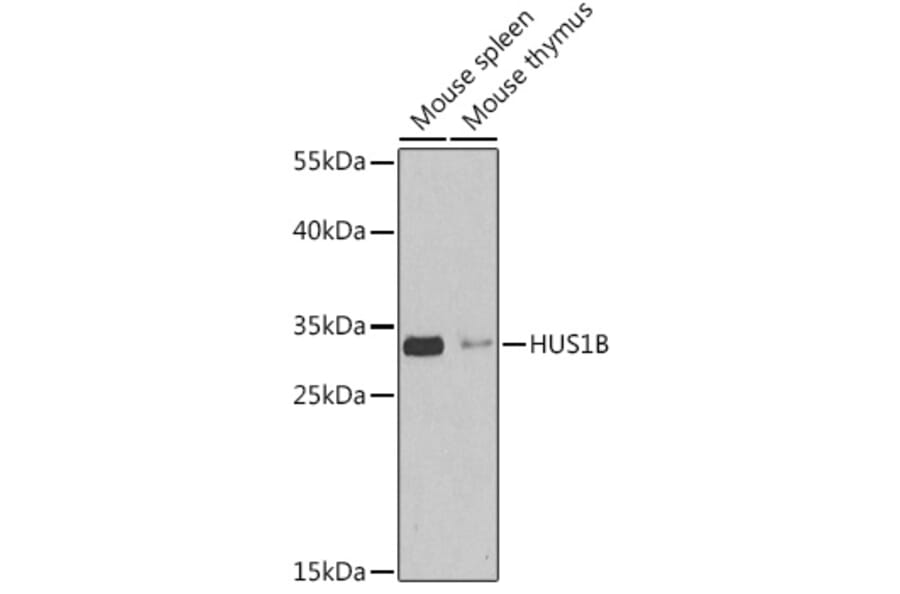Western Blot - Anti-HUS1B Antibody (A92076) - Antibodies.com