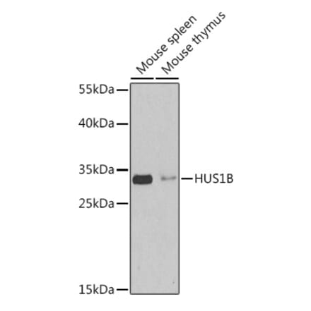 Western Blot - Anti-HUS1B Antibody (A92076) - Antibodies.com