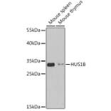 Western Blot - Anti-HUS1B Antibody (A92076) - Antibodies.com