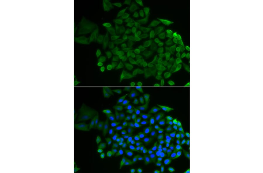 Immunofluorescence - Anti-COG2 Antibody (A12626) - Antibodies.com