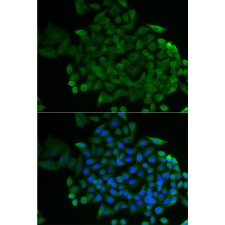 Immunofluorescence - Anti-COG2 Antibody (A12626) - Antibodies.com
