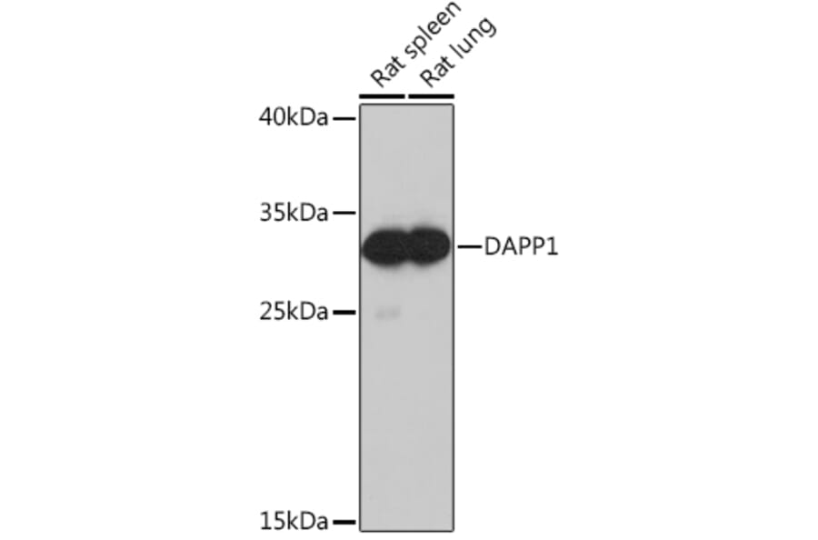 Western Blot - Anti-DAPP1 Antibody (A92079) - Antibodies.com